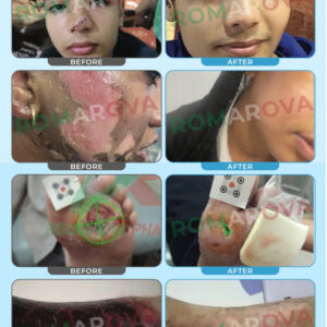 ROMA ROVA Gel Nanosilver 50 ml - Image 8